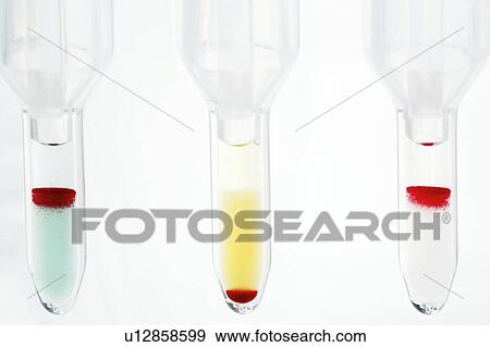 Stock Illustration - Blood group test. Fotosearch