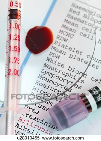 Stock Illustration - Blood test. Fotosearch
