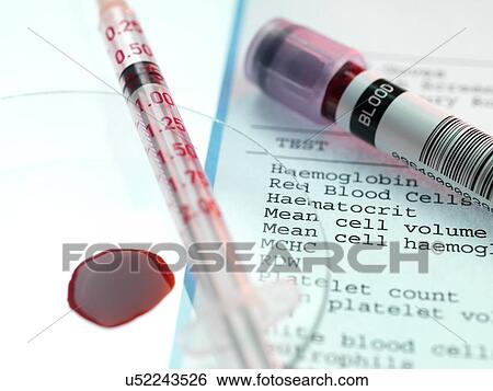 Stock Illustration - Blood test. Fotosearch