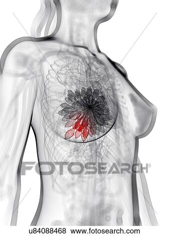 Breast cancer, artwork View Large Illustration Stock Illustration - Breast cancer, artwork. Fotosearch