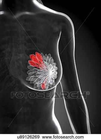 Breast cancer, artwork View Large Illustration Stock Illustration - Breast cancer, artwork. Fotosearch