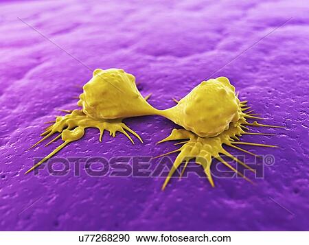 Cancer cells dividing, artwork View Large Illustration Clipart - Cancer cells dividing, artwork. Fotosearch