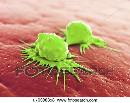 Stock Illustration - Cancer cells dividing, artwork. Fotosearch