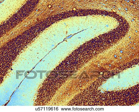 Stock Illustration - Cerebellum tissue, light micrograph. Fotosearch