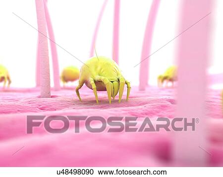 Clipart - Dust mite, artwork. Fotosearch