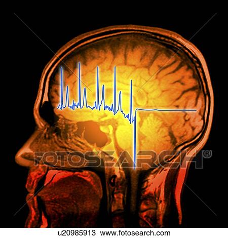 ECG trace and mri brain scan, artwork View Large Illustration Drawing - ECG trace and mri brain scan, artwork. Fotosearch