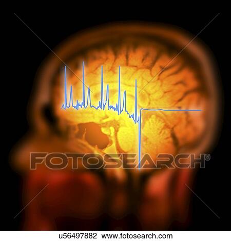 Drawing - ECG trace and mri brain scan, artwork. Fotosearch