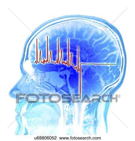 Drawing - ECG trace and mri brain scan, artwork. Fotosearch