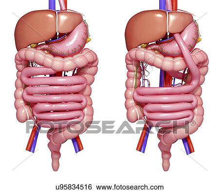 Gastric bypass, artwork View Large Illustration Stock Illustration - Gastric bypass, artwork. Fotosearch