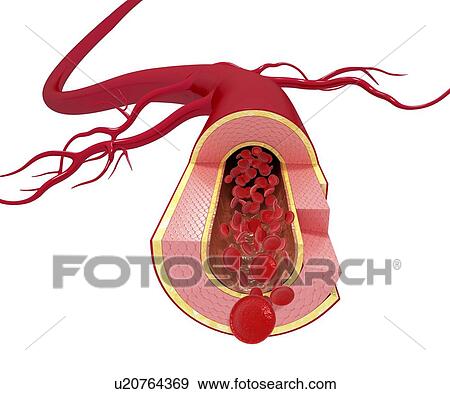 Healthy artery, artwork View Large Illustration Stock Illustration - Healthy artery, artwork. Fotosearch