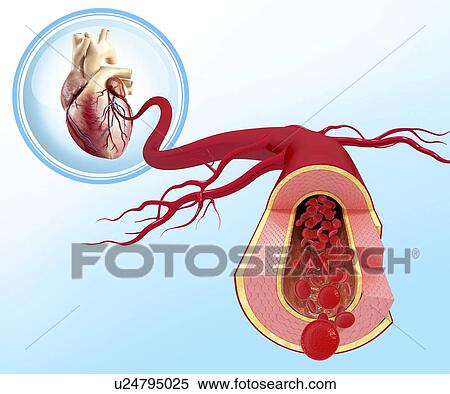 Healthy artery, artwork View Large Illustration Stock Illustration - Healthy artery, artwork. Fotosearch