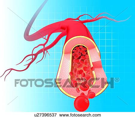 Healthy artery, artwork View Large Illustration Stock Illustration - Healthy artery, artwork. Fotosearch