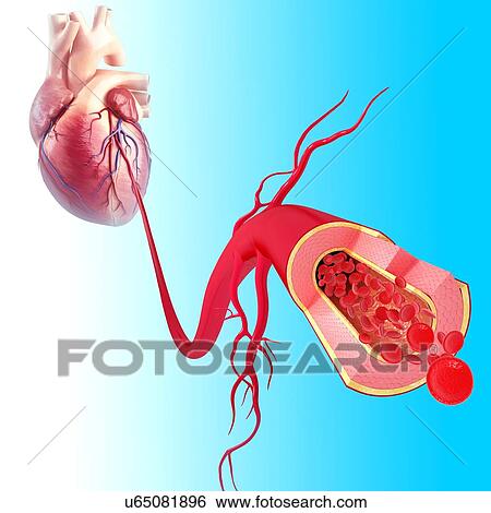 Healthy artery, artwork View Large Illustration Stock Illustration - Healthy artery, artwork. Fotosearch