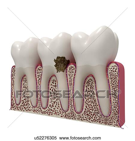 Human teeth, artwork View Large Illustration Stock Illustration - Human teeth, artwork. Fotosearch