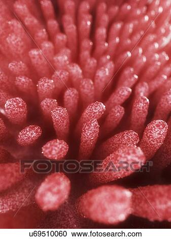 Clipart - Inflamed intestinal villi, artwork. Fotosearch