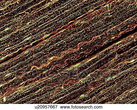 Stock Illustration - Nerve fibres, light micrograph. Fotosearch