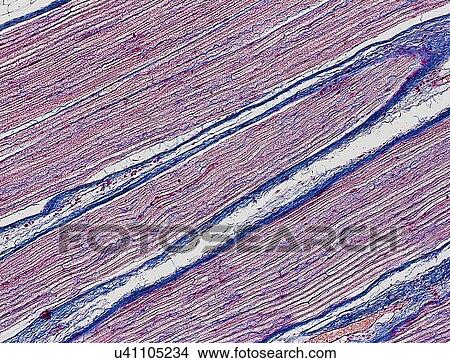Stock Illustration - Nerve fibres, light micrograph. Fotosearch