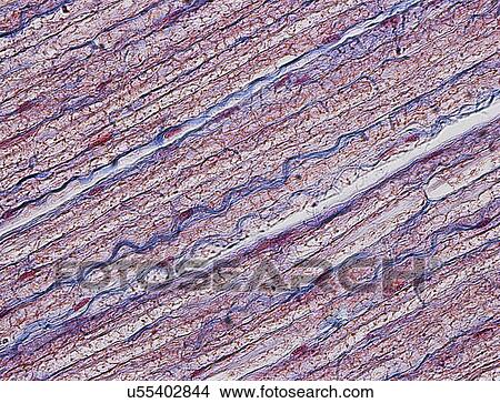 Nerve fibres, light micrograph View Large Illustration Stock Illustration - Nerve fibres, light micrograph. Fotosearch