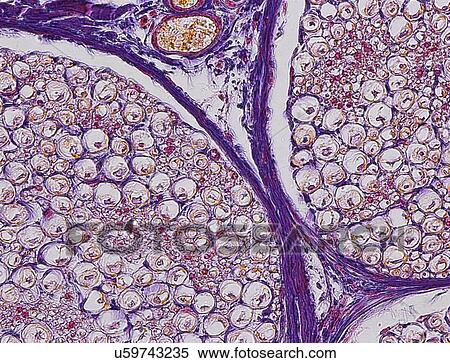 Stock Illustration - Nerve fibres, light micrograph. Fotosearch