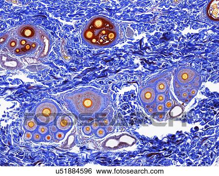 Stock Illustration - Scalp skin showing hair follicles, LM. Fotosearch
