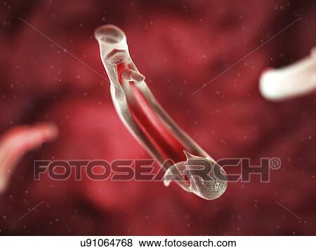Stock Illustration - Schistosome fluke, artwork. Fotosearch