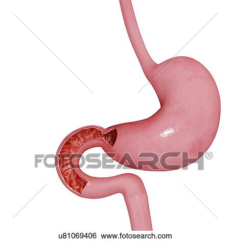 Stomach and small intestines, artwork View Large Illustration Stock Illustration - Stomach and small intestines, artwork. Fotosearch