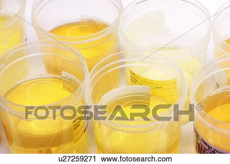 Clip Art - Urine samples. Fotosearch