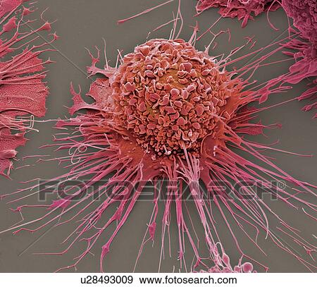 Activated macrophage, SEM View Large Illustration Stock Illustration - Activated macrophage, SEM. Fotosearch