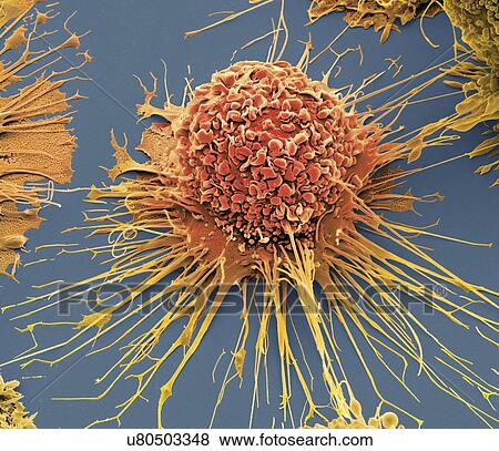 Stock Illustration - Activated macrophage, SEM. Fotosearch