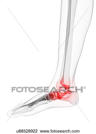 Ankle pain, conceptual artwork View Large Illustration Drawing - Ankle pain, conceptual artwork. Fotosearch