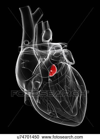 Clipart - Aortic valve, artwork. Fotosearch