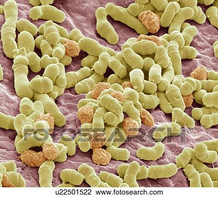 Athlete's foot fungus, SEM View Large Illustration Drawing - Athlete's foot fungus, SEM. Fotosearch