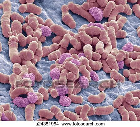 Athlete's foot fungus, SEM View Large Illustration Stock Illustration - Athlete's foot fungus, SEM. Fotosearch