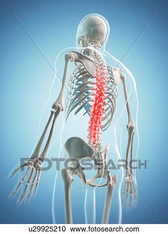 Back pain, conceptual artwork View Large Illustration Clipart - Back pain, conceptual artwork. Fotosearch