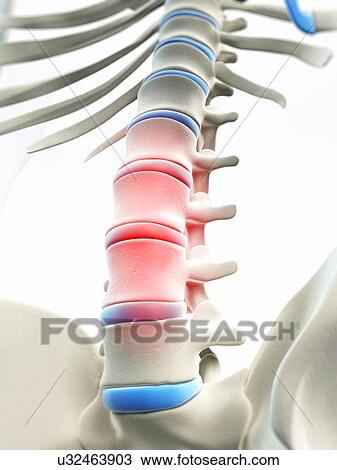 Back pain, conceptual artwork View Large Illustration Drawing - Back pain, conceptual artwork. Fotosearch
