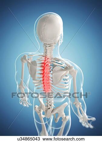 Drawing - Back pain, conceptual artwork. Fotosearch