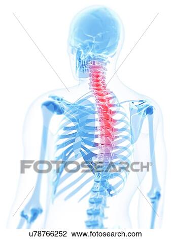 Back pain, conceptual artwork View Large Illustration Drawing - Back pain, conceptual artwork. Fotosearch