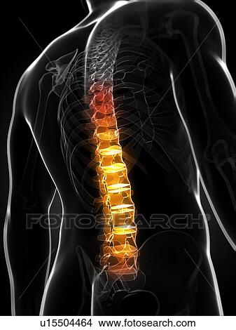 Back pain, conceptual artwork View Large Illustration Stock Illustration - Back pain, conceptual artwork. Fotosearch