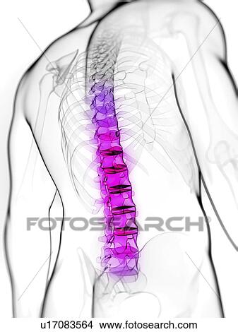 Stock Illustration - Back pain, conceptual artwork. Fotosearch
