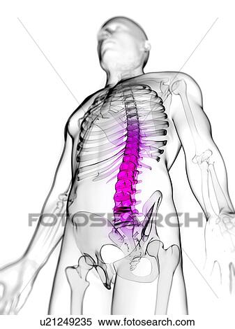 Stock Illustration - Back pain, conceptual artwork. Fotosearch