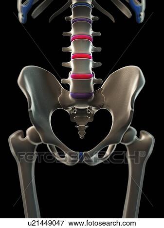 Stock Illustration - Back pain, conceptual artwork. Fotosearch