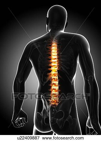 Stock Illustration - Back pain, conceptual artwork. Fotosearch