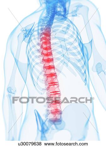 Back pain, conceptual artwork View Large Illustration Stock Illustration - Back pain, conceptual artwork. Fotosearch