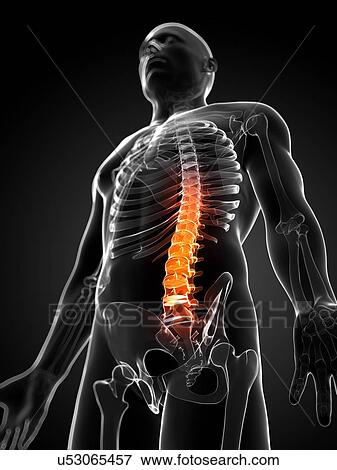 Back pain, conceptual artwork View Large Illustration Stock Illustration - Back pain, conceptual artwork. Fotosearch
