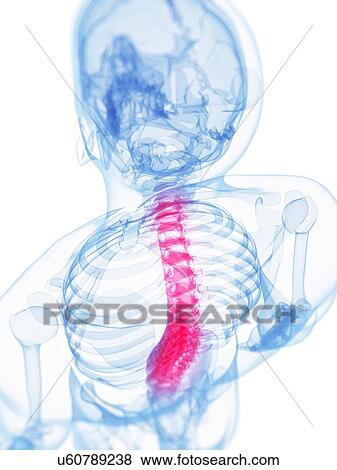 Back pain, conceptual artwork View Large Illustration Stock Illustration - Back pain, conceptual artwork. Fotosearch