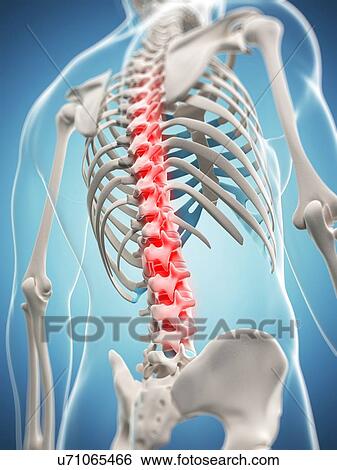 Stock Illustration - Back pain, conceptual artwork. Fotosearch