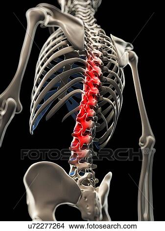 Back pain, conceptual artwork View Large Illustration Stock Illustration - Back pain, conceptual artwork. Fotosearch