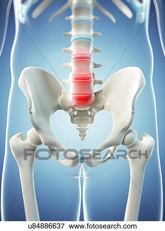 Back pain, conceptual artwork View Large Illustration Stock Illustration - Back pain, conceptual artwork. Fotosearch