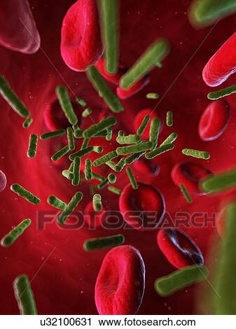 Bacterial infection, artwork View Large Illustration Clip Art - Bacterial infection, artwork. Fotosearch