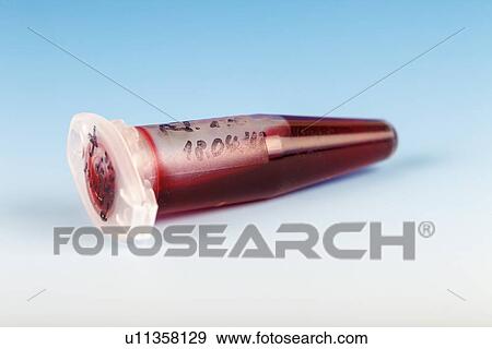 Biological sample View Large Illustration Stock Illustration - Biological sample. Fotosearch